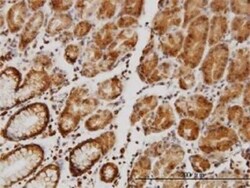 NHE1/SLC9A1 Antibody (2F5), Novus Biologicals 0.1 mg | Buy Online | Novus Biologicals | Fisher Scientific