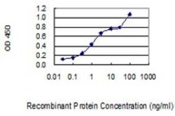 Nurr1/NGFI-B beta/NR4A2 Antibody (2G5), Novus Biologicals 0.1 mg | Buy Online | Novus Biologicals | Fisher Scientific