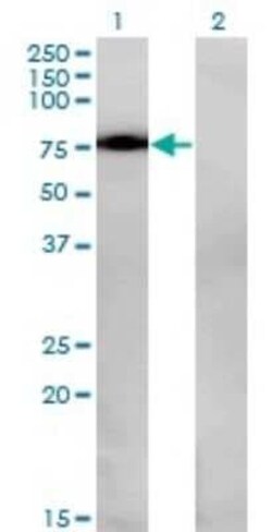 Nurr1/NGFI-B beta/NR4A2 Antibody (2G5), Novus Biologicals 0.1 mg | Buy Online | Novus Biologicals | Fisher Scientific
