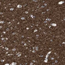 PMCA1 Antibody, Novus Biologicals 0.1 mL, Unconjugated:Antibodies, Polyclonal