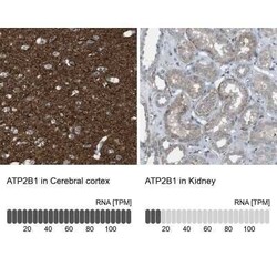 PMCA1 Antibody, Novus Biologicals 0.1 mL, Unconjugated:Antibodies, Polyclonal