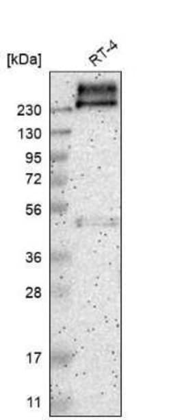 PMCA1 Antibody, Novus Biologicals 0.1 mL, Unconjugated:Antibodies, Polyclonal