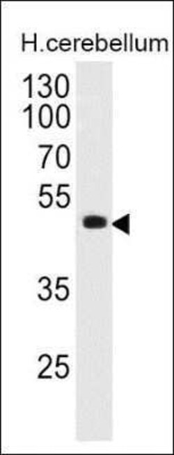Pax6 Antibody (PAX6/498) - Azide and BSA Free, Novus Biologicals 0.1 mg | Buy Online | Novus Biologicals | Fisher Scientific