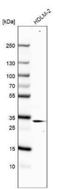 RACK1/GNB2L1 Antibody, Novus Biologicals 0.1 mL | Buy Online | Novus Biologicals | Fisher Scientific