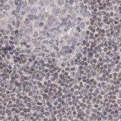 RAP80 Antibody, Novus Biologicals 0.1 mL | Buy Online | Novus Biologicals | Fisher Scientific