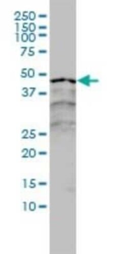 RAR alpha/NR1B1 Antibody (2C9-1F8), Novus Biologicals 0.1 mg | Buy Online | Novus Biologicals | Fisher Scientific