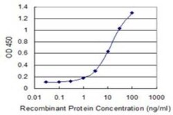 RBM6 Antibody (4B3), Novus Biologicals 0.1 mg; Unconjugated:Antibodies,