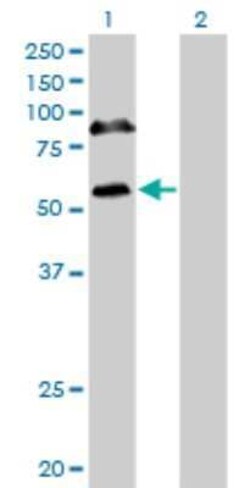 RBM6 Antibody (4B3), Novus Biologicals 0.1 mg; Unconjugated:Antibodies,