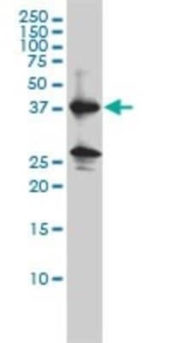 Renin Antibody (2H2), Novus Biologicals 0.1 mg | Buy Online | Novus Biologicals | Fisher Scientific