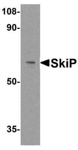 SNW1 Antibody - BSA Free, Novus Biologicals 0.1 mg | Buy Online | Novus Biologicals | Fisher Scientific