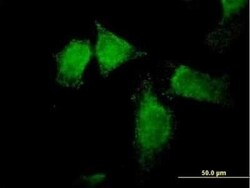 SNX13 Antibody, Novus Biologicals 0.05 mg | Buy Online | Novus Biologicals | Fisher Scientific