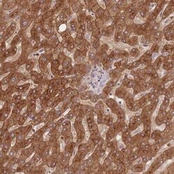 STEAP3/TSAP6 Antibody, Novus Biologicals 0.1 mL | Buy Online | Novus Biologicals | Fisher Scientific