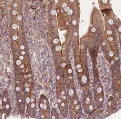 STEAP3/TSAP6 Antibody, Novus Biologicals 0.1 mL | Buy Online | Novus Biologicals | Fisher Scientific