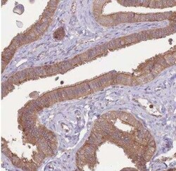 STEAP3/TSAP6 Antibody, Novus Biologicals 0.1 mL | Buy Online | Novus Biologicals | Fisher Scientific