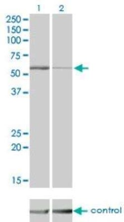 STK38 Antibody (2F3), Novus Biologicals 0.1 mg | Buy Online | Novus Biologicals | Fisher Scientific