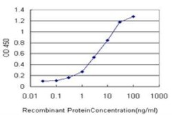 STK38 Antibody (2F6), Novus Biologicals 0.1 mg | Buy Online | Novus Biologicals | Fisher Scientific