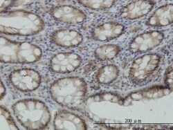 STK38 Antibody (2F6), Novus Biologicals 0.1 mg | Buy Online | Novus Biologicals | Fisher Scientific