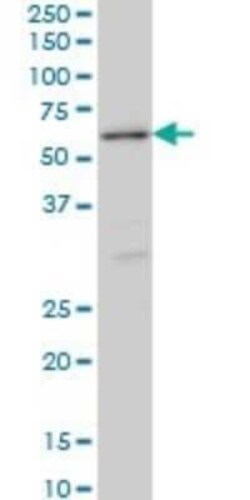STK38 Antibody (2F6), Novus Biologicals 0.1 mg | Buy Online | Novus Biologicals | Fisher Scientific
