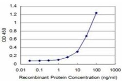 STYK1 Antibody (3D2), Novus Biologicals 0.1 mg | Buy Online | Novus Biologicals | Fisher Scientific