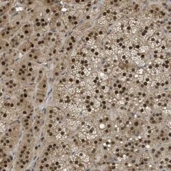 SUG1 Antibody, Novus Biologicals 0.1 mL, Unconjugated:Antikörper