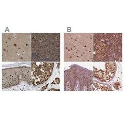 SUG1 Antibody, Novus Biologicals 0.1 mL, Unconjugated:Antikörper
