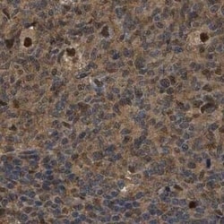 SUG1 Antibody, Novus Biologicals 0.1 mL, Unconjugated:Antikörper