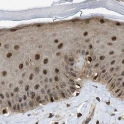 SUG1 Antibody, Novus Biologicals 0.1 mL, Unconjugated:Antikörper