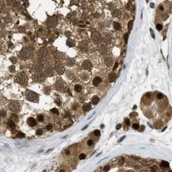 SUG1 Antibody, Novus Biologicals 0.1 mL, Unconjugated:Antikörper