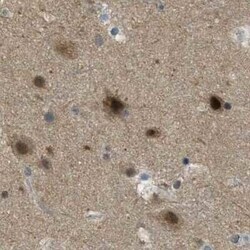 SUG1 Antibody, Novus Biologicals 0.1 mL, Unconjugated:Antikörper