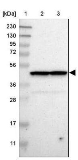 SUG1 Antibody, Novus Biologicals 0.1 mL, Unconjugated:Antikörper