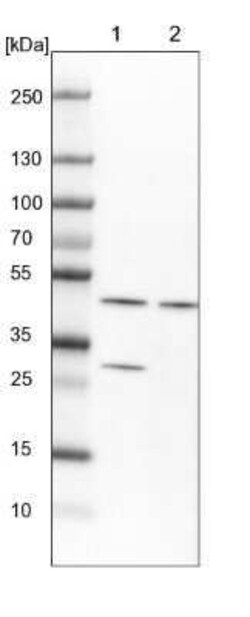 SUG1 Antibody, Novus Biologicals 0.1 mL, Unconjugated:Antikörper