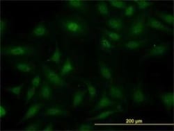 SUGT1 Antibody (6G5), Novus Biologicals 0.1 mg; Unconjugated:Antibodies,