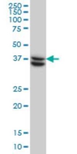 SUGT1 Antibody (6G5), Novus Biologicals 0.1 mg; Unconjugated:Antibodies,