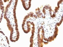 SUMO1 Antibody (SPM571) - Azide and BSA Free, Novus Biologicals 0.1 mg,