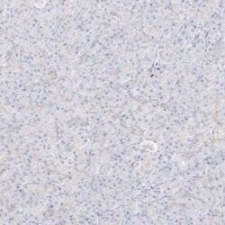 Sirtuin 5/SIRT5 Antibody, Novus Biologicals 0.1 mL | Buy Online | Novus Biologicals | Fisher Scientific