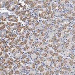Sirtuin 5/SIRT5 Antibody, Novus Biologicals 0.1 mL | Buy Online | Novus Biologicals | Fisher Scientific