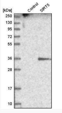 Sirtuin 5/SIRT5 Antibody, Novus Biologicals 0.1 mL | Buy Online | Novus Biologicals | Fisher Scientific
