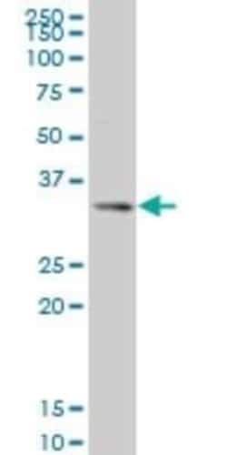 SIX3 Antibody (2B9), Novus Biologicals 0.1 mg | Buy Online | Novus Biologicals | Fisher Scientific