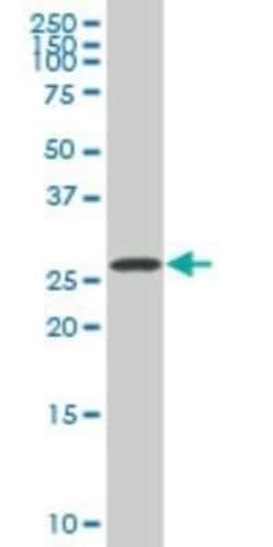 SIX3 Antibody (2B9), Novus Biologicals 0.1 mg | Buy Online | Novus Biologicals | Fisher Scientific