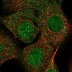 Syntenin 1 Antibody, Novus Biologicals 0.1 mL | Buy Online | Novus Biologicals | Fisher Scientific