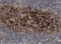 Syntenin 1 Antibody, Novus Biologicals 0.1 mL | Buy Online | Novus Biologicals | Fisher Scientific