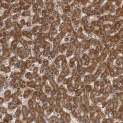 Syntenin 1 Antibody, Novus Biologicals 0.1 mL | Buy Online | Novus Biologicals | Fisher Scientific