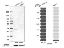 Syntenin 1 Antibody, Novus Biologicals 0.1 mL | Buy Online | Novus Biologicals | Fisher Scientific
