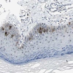 TACC3 Antibody, Novus Biologicals 0.1 mL; Unconjugated:Antibodies, Polyclonal