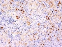 TNF-alpha Antibody (TNF706 + P/T2) - Azide and BSA Free, Novus Biologicals