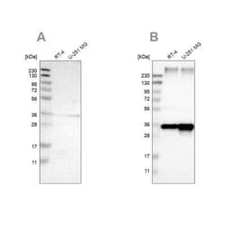 TRAP alpha Antibody, Novus Biologicals 0.1 mL; Unconjugated:Antibodies,