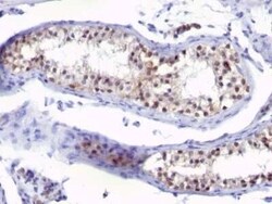 Thymidylate Synthase Antibody (SPM453) - Azide and BSA Free, Novus Biologicals