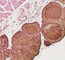 Thyroglobulin Antibody (2H11 + 6E1) - Azide and BSA Free, Novus Biologicals 0.1 mg | Buy Online | Novus Biologicals | Fisher Scientific