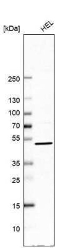 UBP1 Antibody, Novus Biologicals 0.1 mL | Buy Online | Novus Biologicals | Fisher Scientific