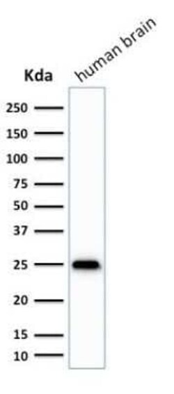 UCH-L1/PGP9.5 Antibody (SPM575) - Azide and BSA Free, Novus Biologicals 0.1 mg | Buy Online | Novus Biologicals | Fisher Scientific